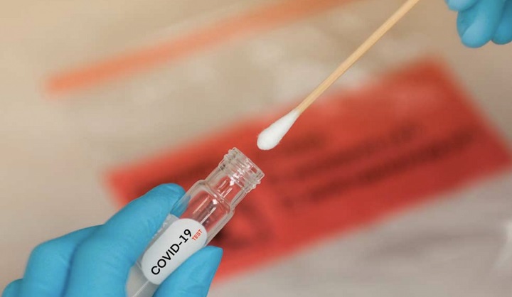 Iniciarán controles de costo para pruebas PCR de Covid-19