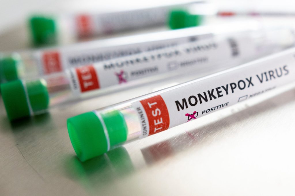 OMS confirma más de 5.000 casos de viruela del mono en el mundo