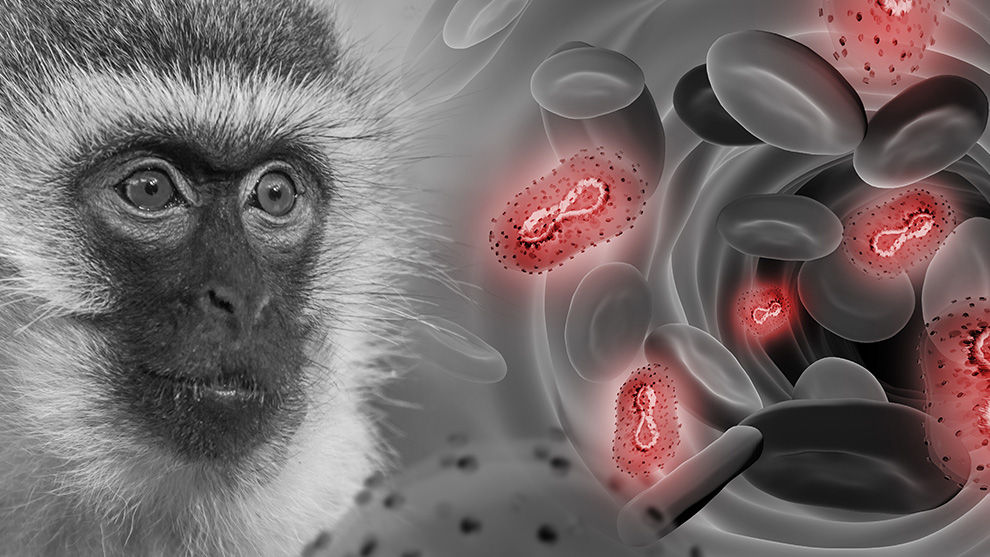 Reportan dos casos de viruela del mono en Cochabamba