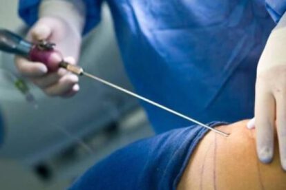 Joven afectada por mini lipo negligencia médica