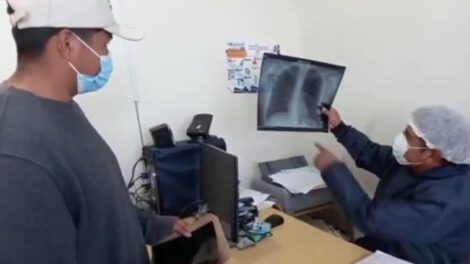 Tuberculosis en Bolivia