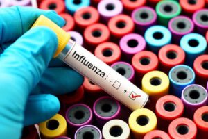 casos de influenza en Santa Cruz