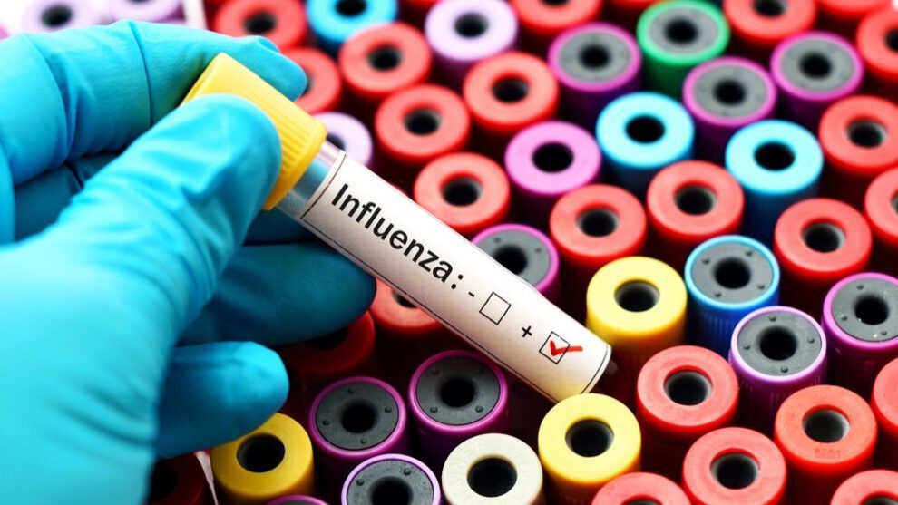 casos de influenza en Santa Cruz