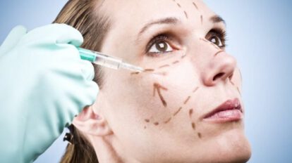 inyecciones de bótox y sus efectos en la salud