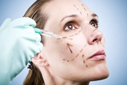 inyecciones de bótox y sus efectos en la salud