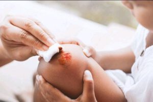 Día Internacional de la Hemofilia: Desafíos y costos que impactan a varias familias