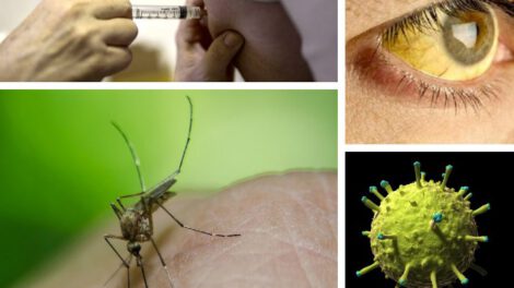 fiebre amarilla es una enfermedad vírica aguda y hemorrágica