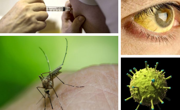 fiebre amarilla es una enfermedad vírica aguda y hemorrágica