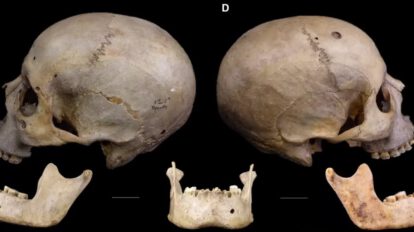 Cirugía oncológica en Egipto hace más de 4.000 años