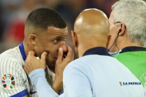 Kylian Mbappé fractura de nariz