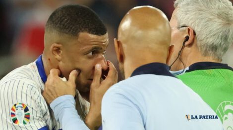 Kylian Mbappé fractura de nariz