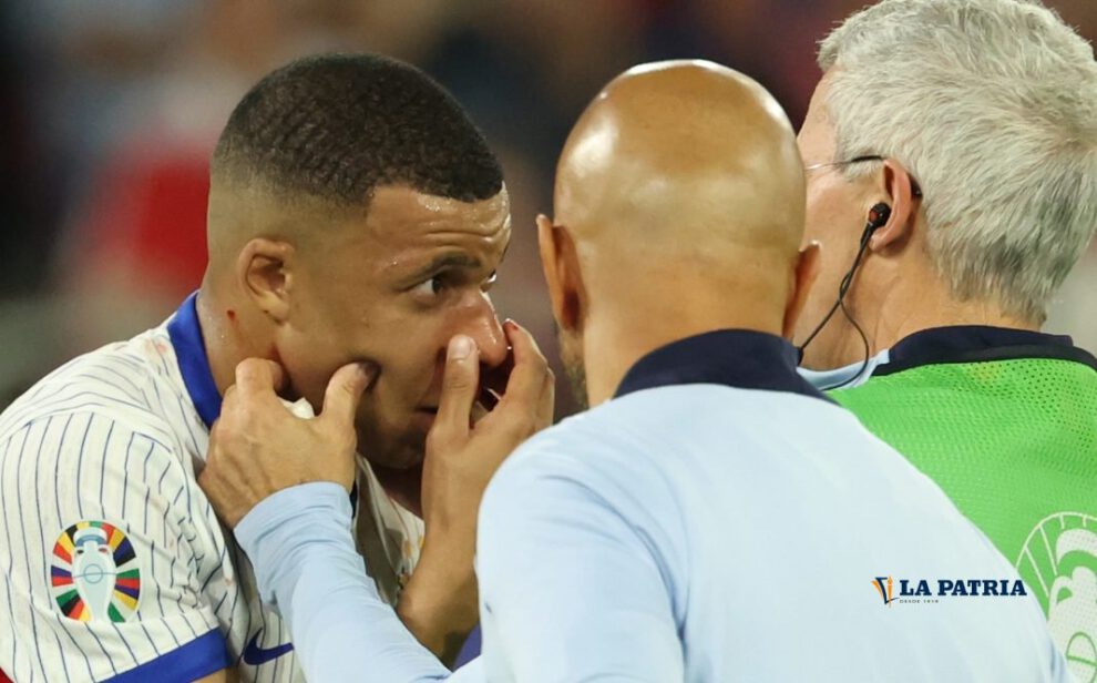 Kylian Mbappé fractura de nariz