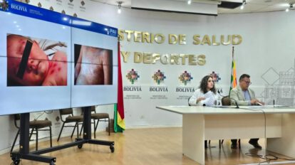 alerta epidemiológica sarampión Oruro