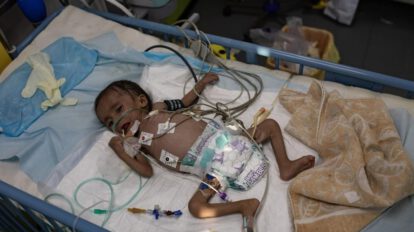 Crisis humanitaria en Gaza: Niños mueren por hambruna y desnutrición