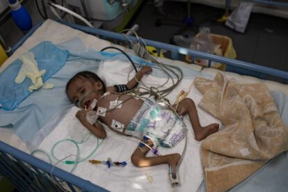 Crisis humanitaria en Gaza: Niños mueren por hambruna y desnutrición