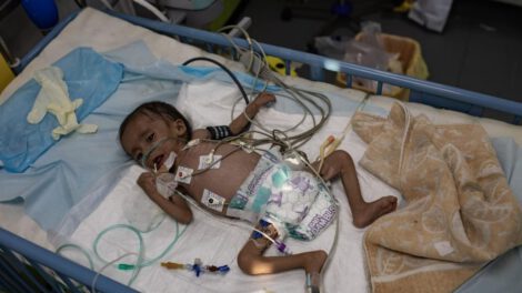 Crisis humanitaria en Gaza: Niños mueren por hambruna y desnutrición