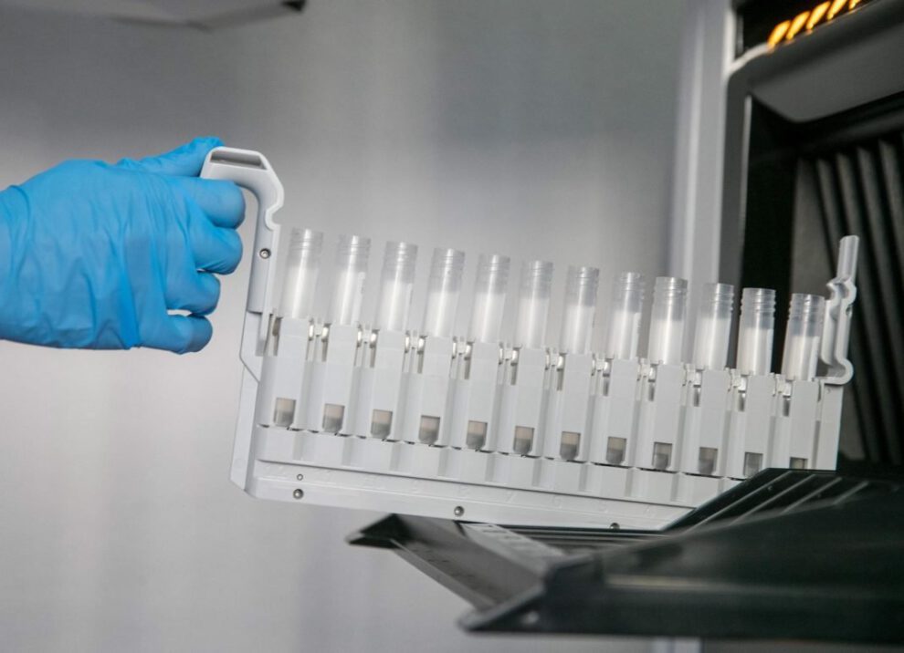 hormona que fortalece huesos en mujeres lactantes