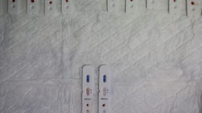 Impacto a largo plazo del Covid-19 en el sistema inmunológico