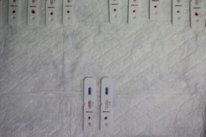 Impacto a largo plazo del Covid-19 en el sistema inmunológico