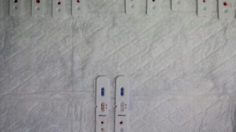 Impacto a largo plazo del Covid-19 en el sistema inmunológico