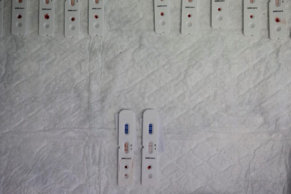 Impacto a largo plazo del Covid-19 en el sistema inmunológico