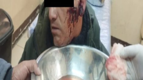 Emboscada en Huanuni deja a 2 sargentos heridos