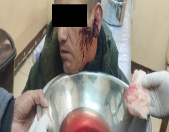 Emboscada en Huanuni deja a 2 sargentos heridos