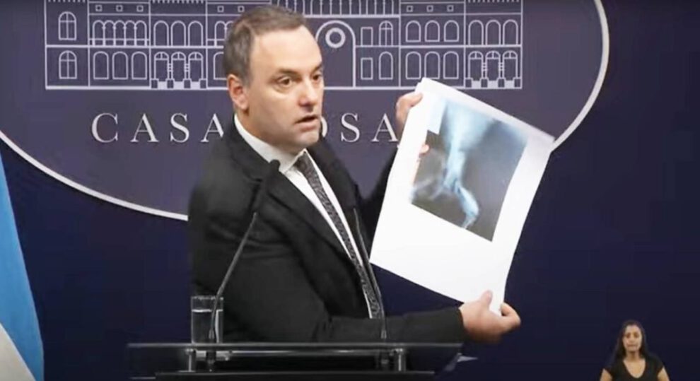 pensión por invalidez en Argentina