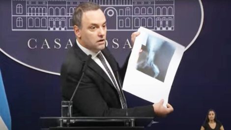 pensión por invalidez en Argentina