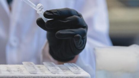 Fármaco contra el cáncer podría ser clave en tratamiento del Alzheimer