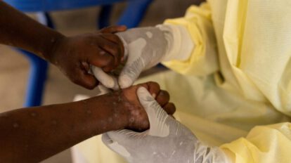 mpox en África