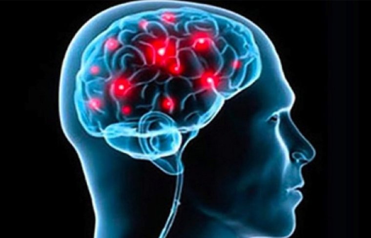 El amor visto desde el cerebro y su activación en diferentes áreas