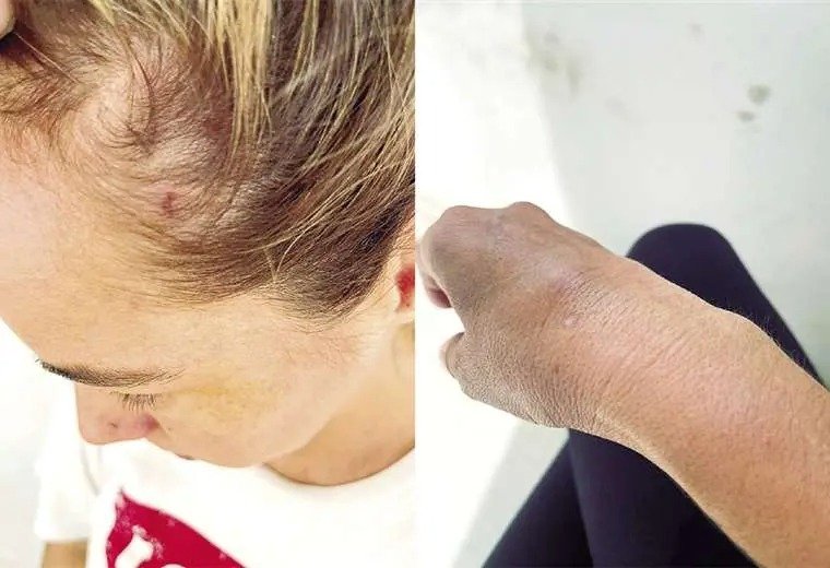 Diego Esteban Mariaca Oblitas imputado por violencia familiar