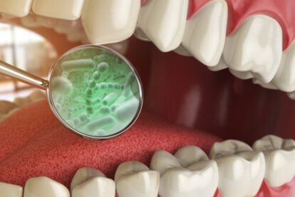 Corynebacterium matruchotii en la boca humana