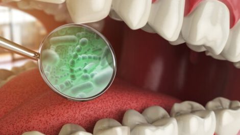 Corynebacterium matruchotii en la boca humana