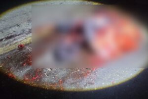 Hombre fallece desmembrado tras ser atropellado