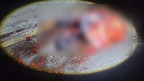 Hombre fallece desmembrado tras ser atropellado