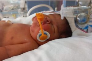 Daine dispositivo respiración para recién nacidos