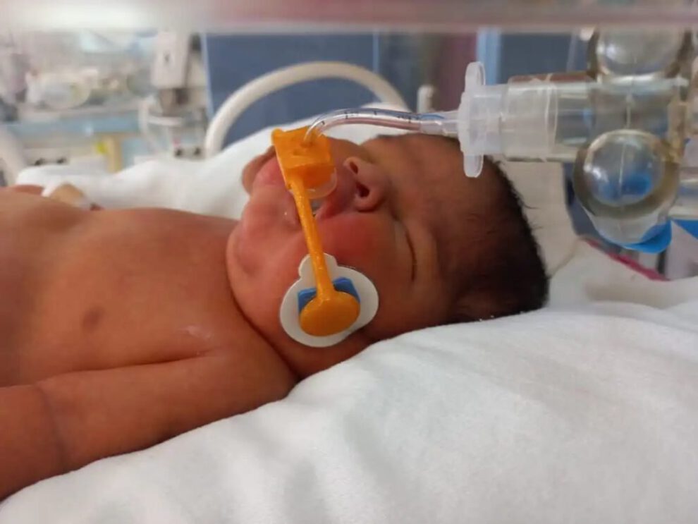 Daine dispositivo respiración para recién nacidos