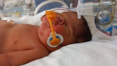 Daine, un dispositivo que salva vidas a neonatos