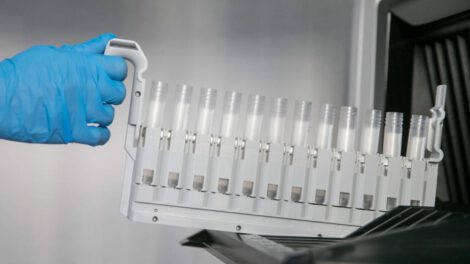 Infecciones por hongos y su impacto en la salud pública