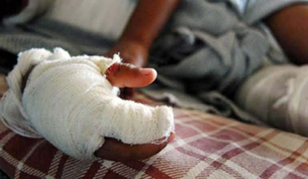 Dos hermanos sufren quemaduras tras confundir gasolina con aceite al cocinar en casa