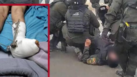 Enfrentamientos en Cochabamba resultan en policías heridos, incluyendo a Nigel Villalobos