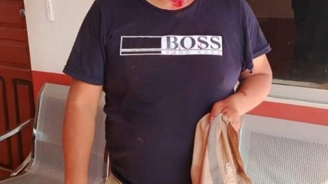 Agresiones a periodistas en Bolivia