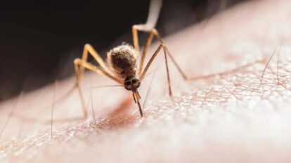 leishmaniasis en un niño