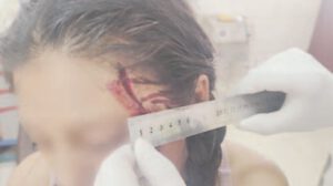 Agresión a expareja en Huanuni