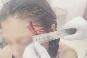 Agresión a expareja en Huanuni