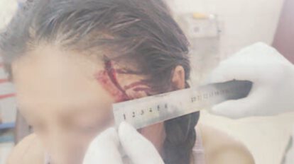 Agresión a expareja en Huanuni
