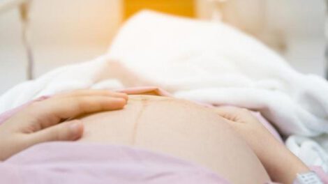 Riña familiar: Mujer embarazada herida por su cuñada