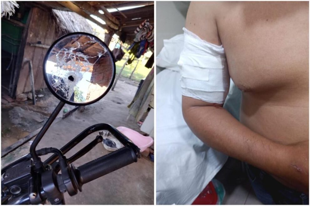 Delincuentes disparan a funcionario en intento por robarle Bs 41.000